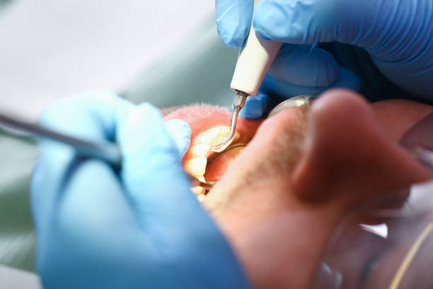 Best Emergency Broken Tooth Repair in Gnadenhutten, OH